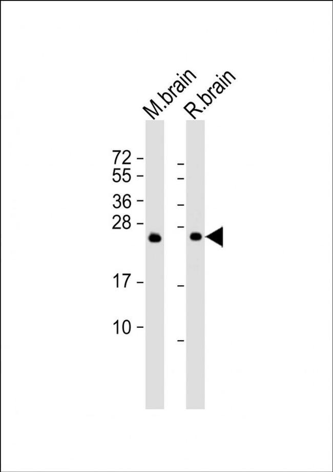 RAB3a Antibody in Western Blot (WB)