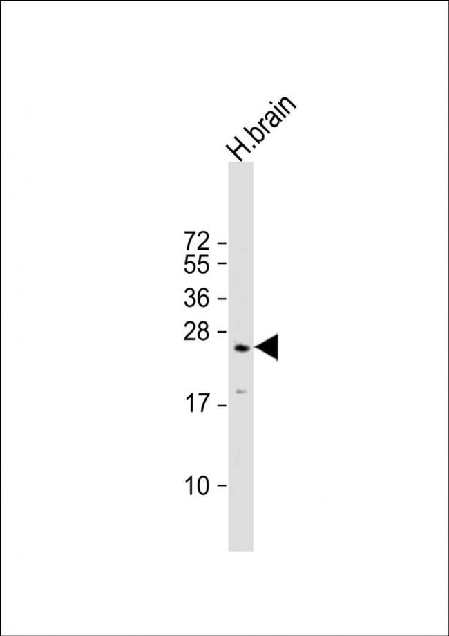 RAB3a Antibody in Western Blot (WB)