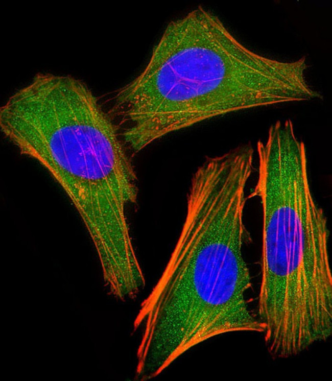 IRF3 Antibody in Immunocytochemistry (ICC/IF)