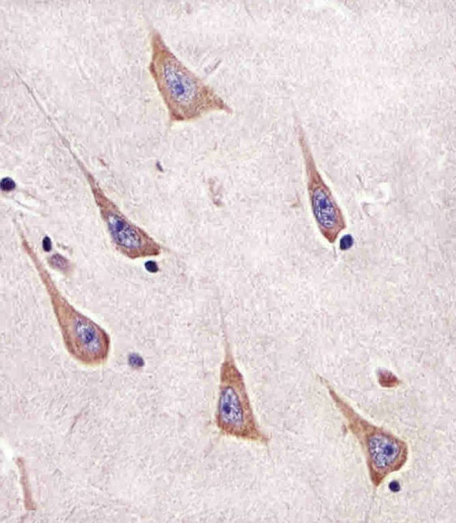 RAB11A Antibody in Immunohistochemistry (Paraffin) (IHC (P))