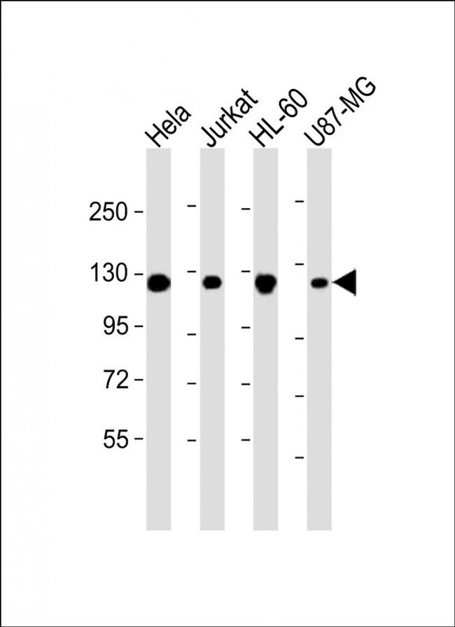 RNF20 Antibody in Western Blot (WB)