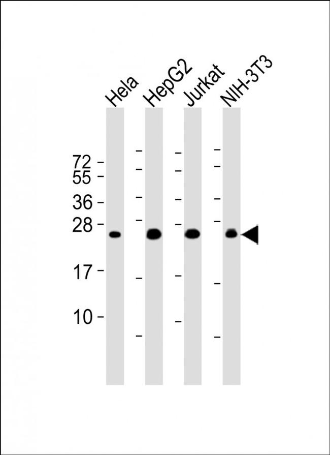 RAB5B Antibody in Western Blot (WB)