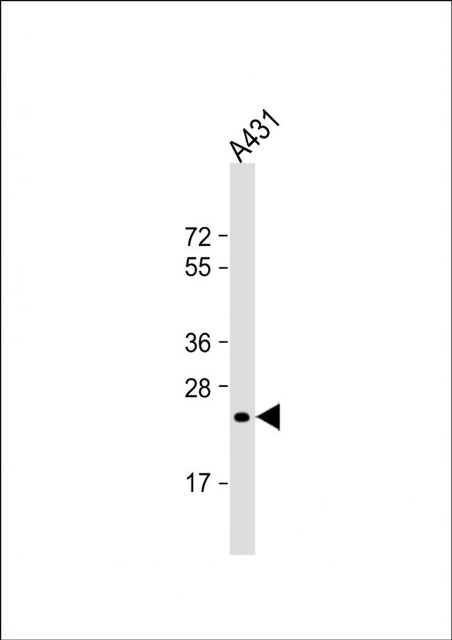 RAB5B Antibody in Western Blot (WB)