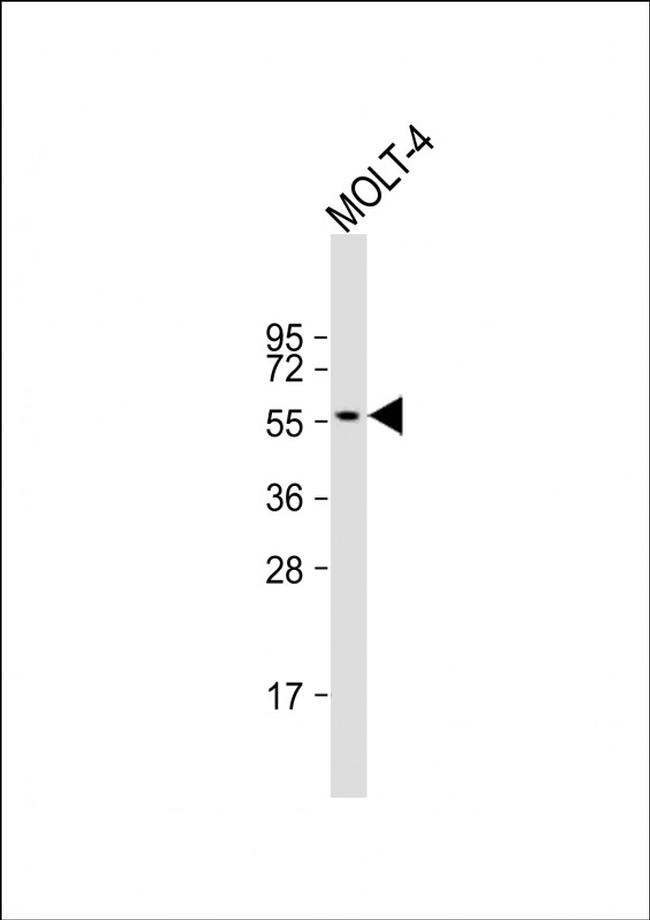 ETS1 Antibody in Western Blot (WB)