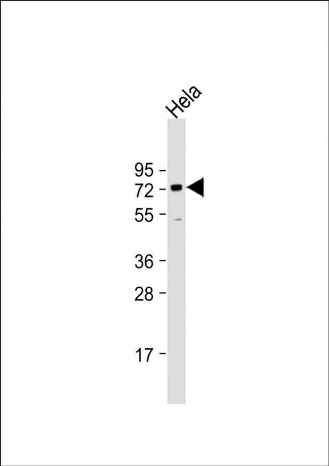 BANP Antibody in Western Blot (WB)