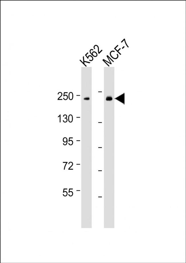 XRN1 Antibody in Western Blot (WB)