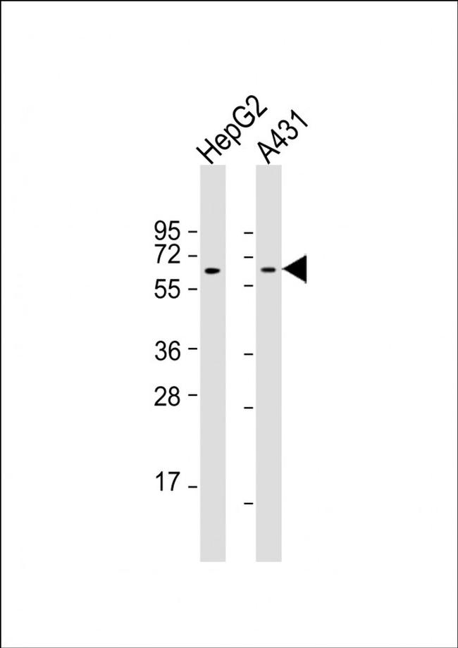 RAP1 Antibody in Western Blot (WB)