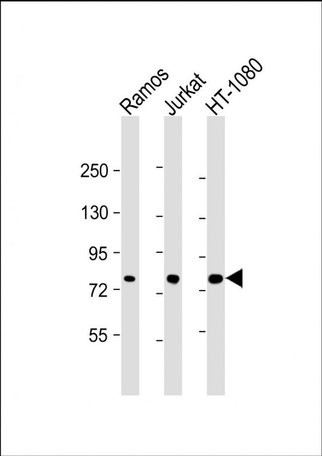 GARS Antibody in Western Blot (WB)