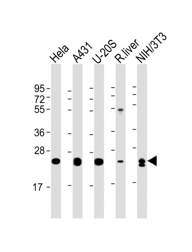 RAB1B Antibody in Western Blot (WB)