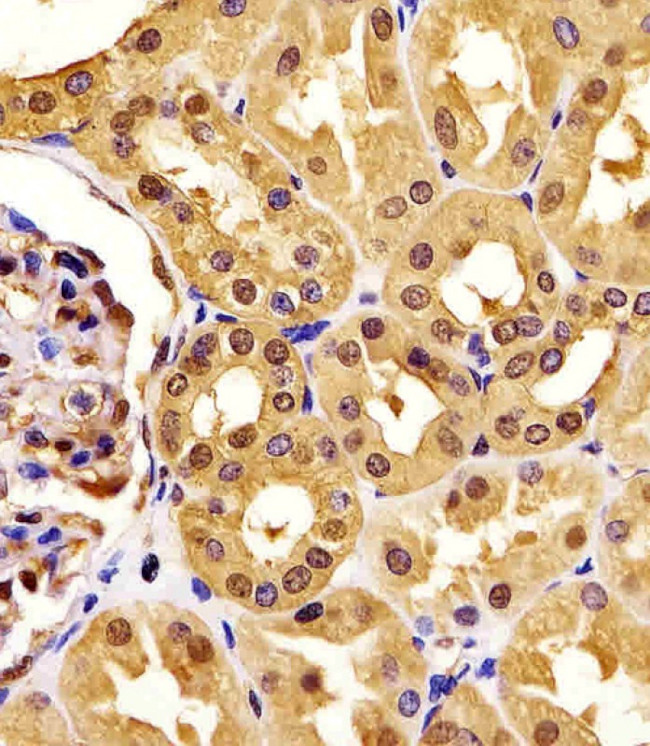 PGK1 Antibody in Immunohistochemistry (Paraffin) (IHC (P))