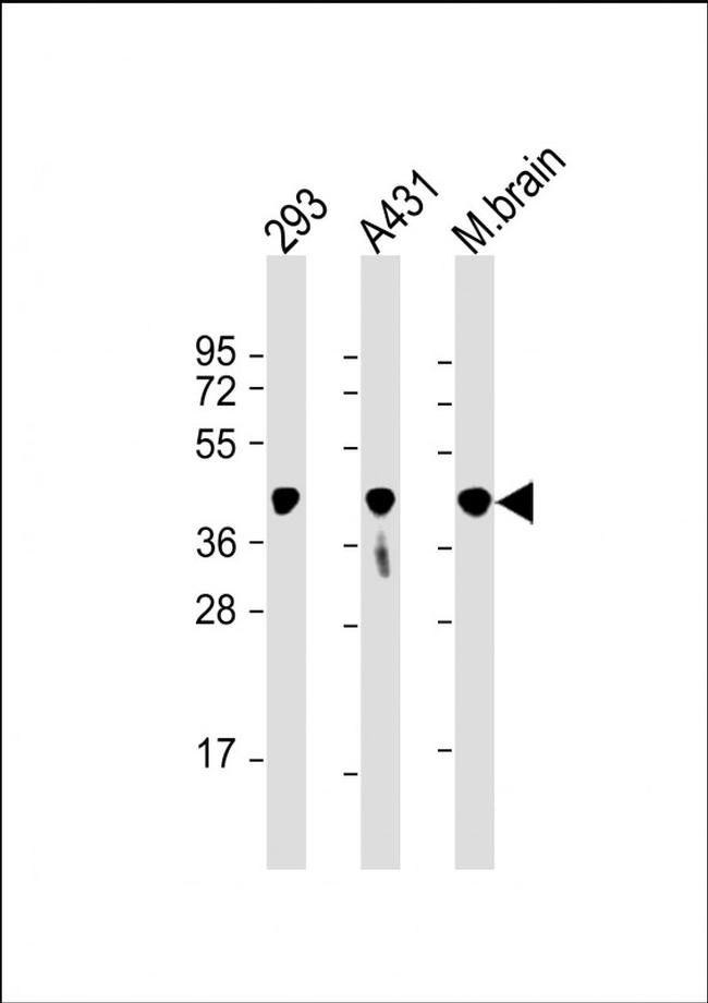 PGK1 Antibody in Western Blot (WB)