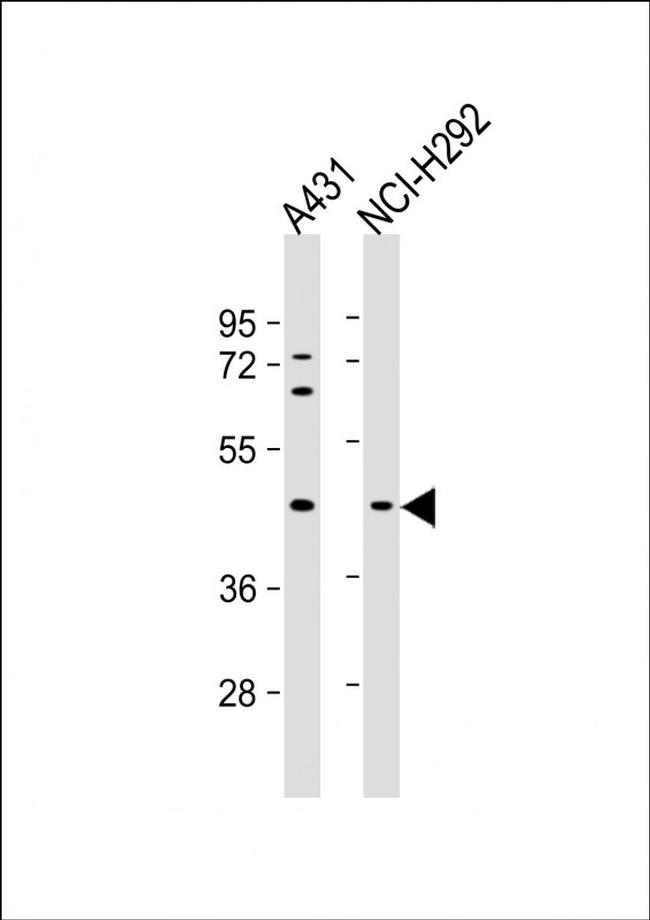 SERPINB3 Antibody in Western Blot (WB)