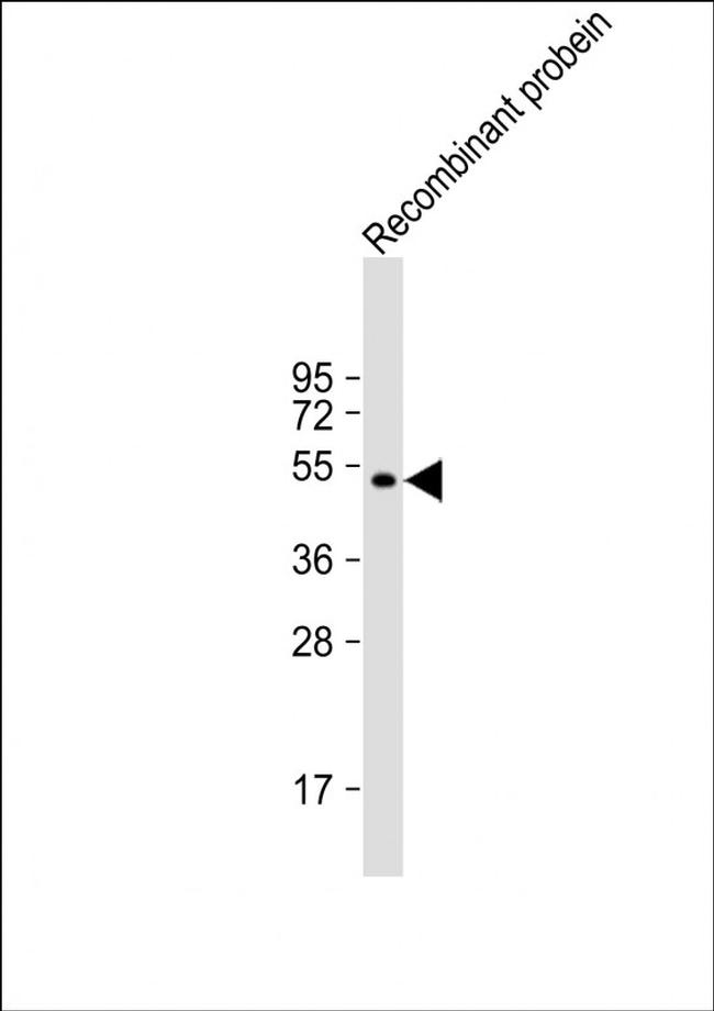 AKAP13 Antibody in Western Blot (WB)