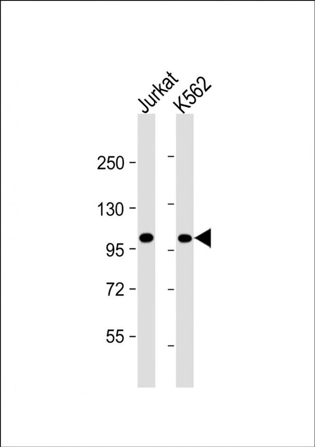 PRDM16 Antibody in Western Blot (WB)