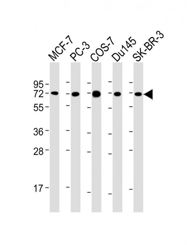 USP2 Antibody in Western Blot (WB)