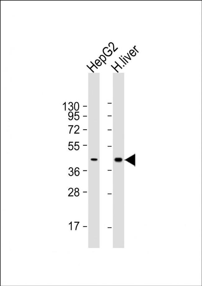 AGXT Antibody in Western Blot (WB)