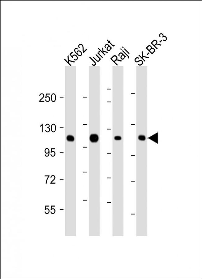 c-Cbl Antibody in Western Blot (WB)