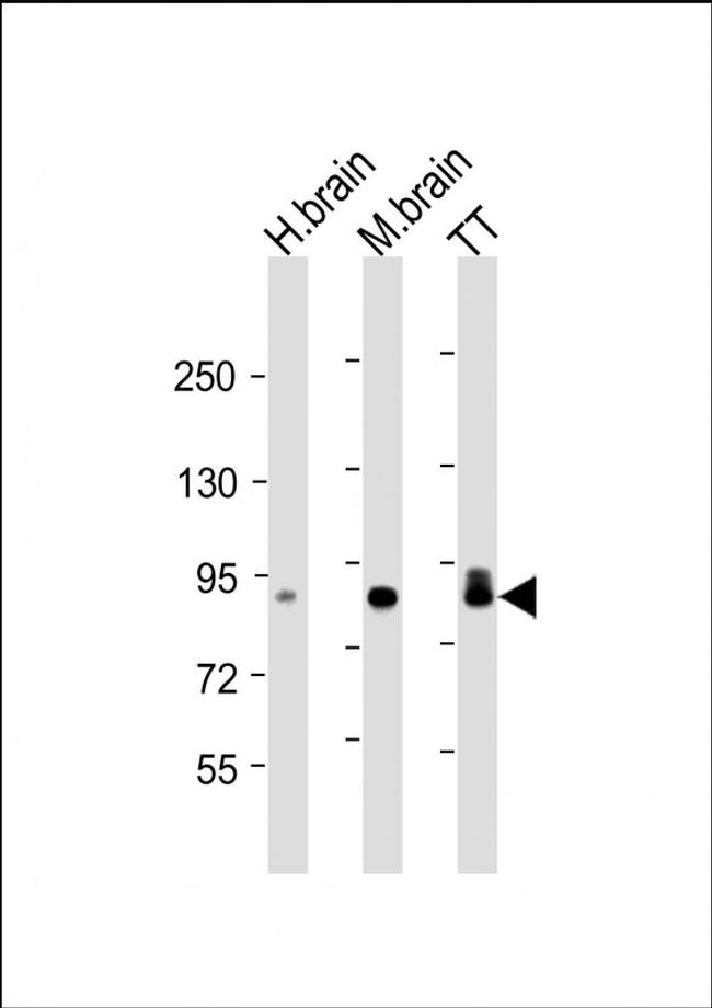 DCLK1 Antibody in Western Blot (WB)