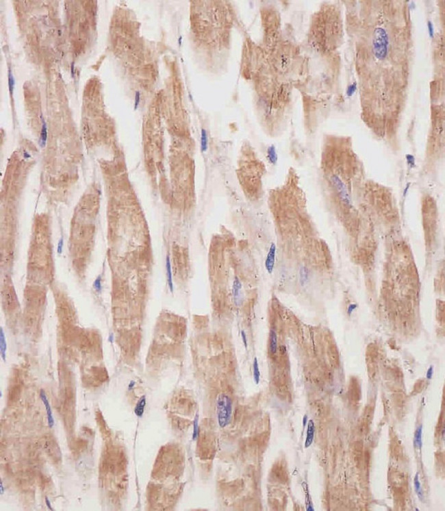 KANK1 Antibody in Immunohistochemistry (Paraffin) (IHC (P))