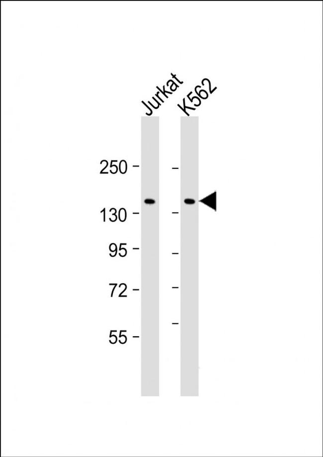 KANK1 Antibody in Western Blot (WB)