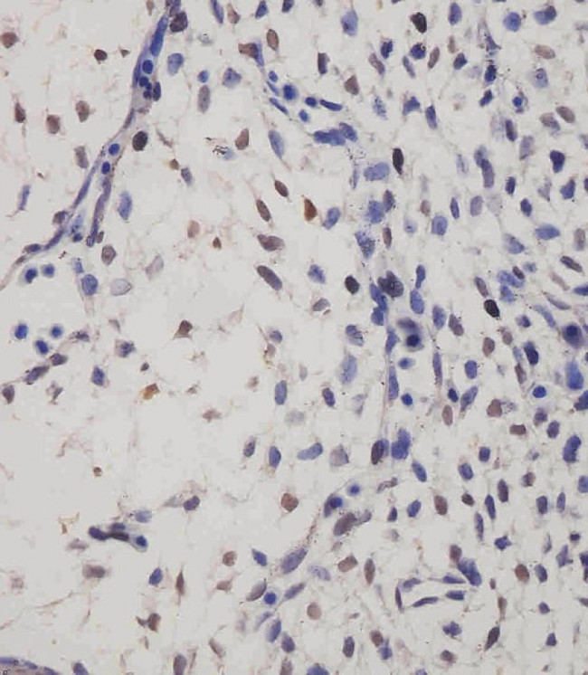 SUFU Antibody in Immunohistochemistry (Paraffin) (IHC (P))