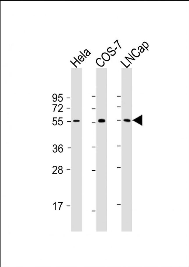 SUFU Antibody in Western Blot (WB)