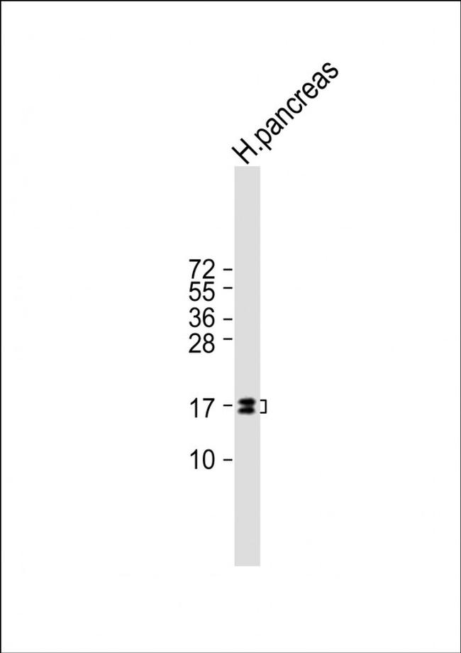 REG3G Antibody in Western Blot (WB)