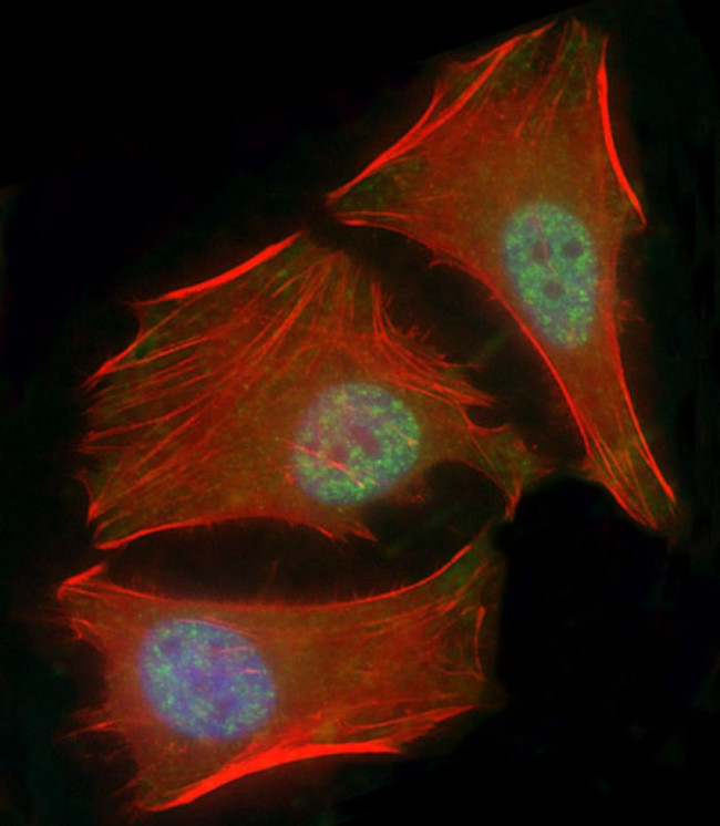 SMAD1 Antibody in Immunocytochemistry (ICC/IF)