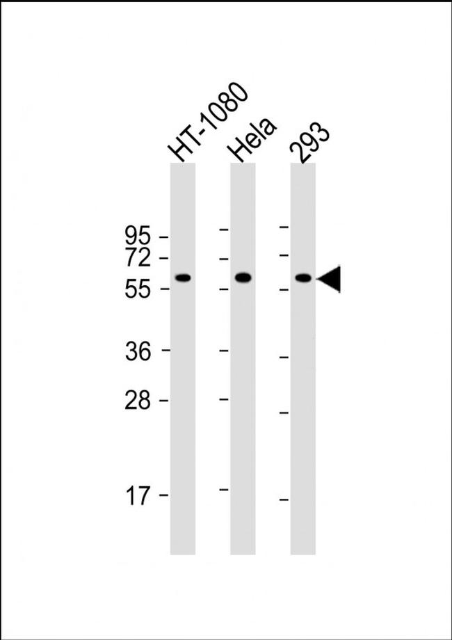 SMAD1 Antibody in Western Blot (WB)