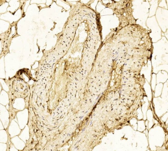 HK2 Antibody in Immunohistochemistry (Paraffin) (IHC (P))