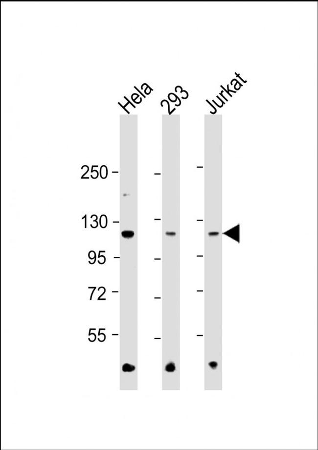 HK2 Antibody in Western Blot (WB)