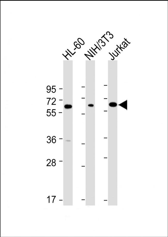 ME2 Antibody in Western Blot (WB)