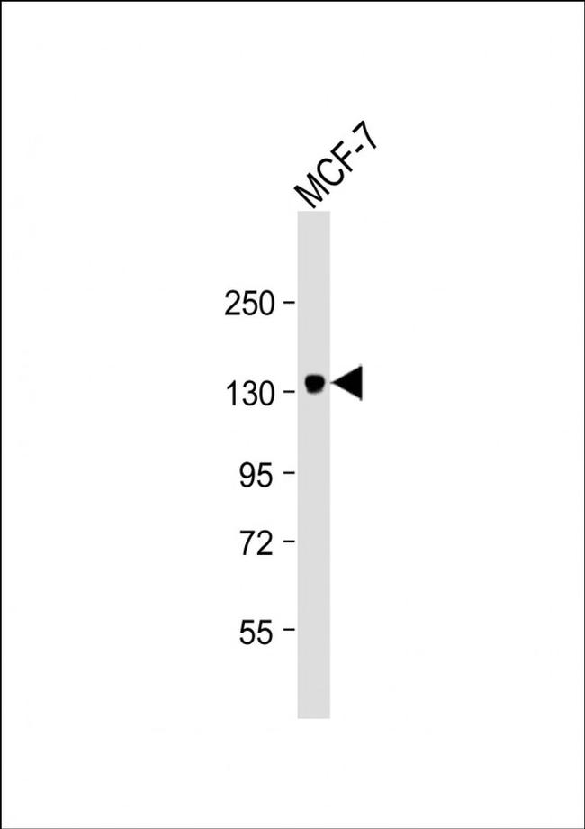 ABCB4 Antibody in Western Blot (WB)