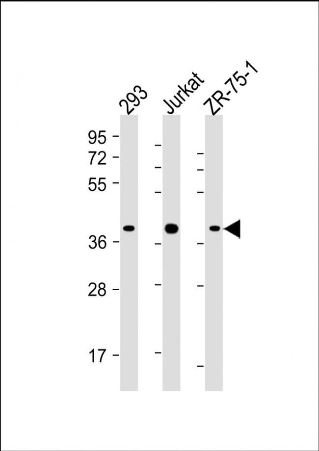 HIF1AN Antibody in Western Blot (WB)