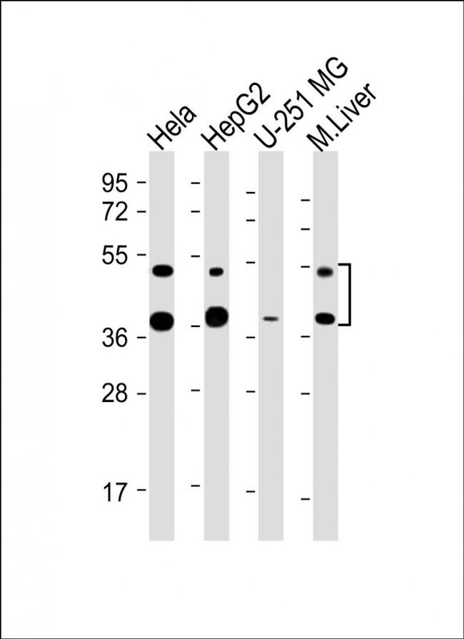 FDPS Antibody in Western Blot (WB)