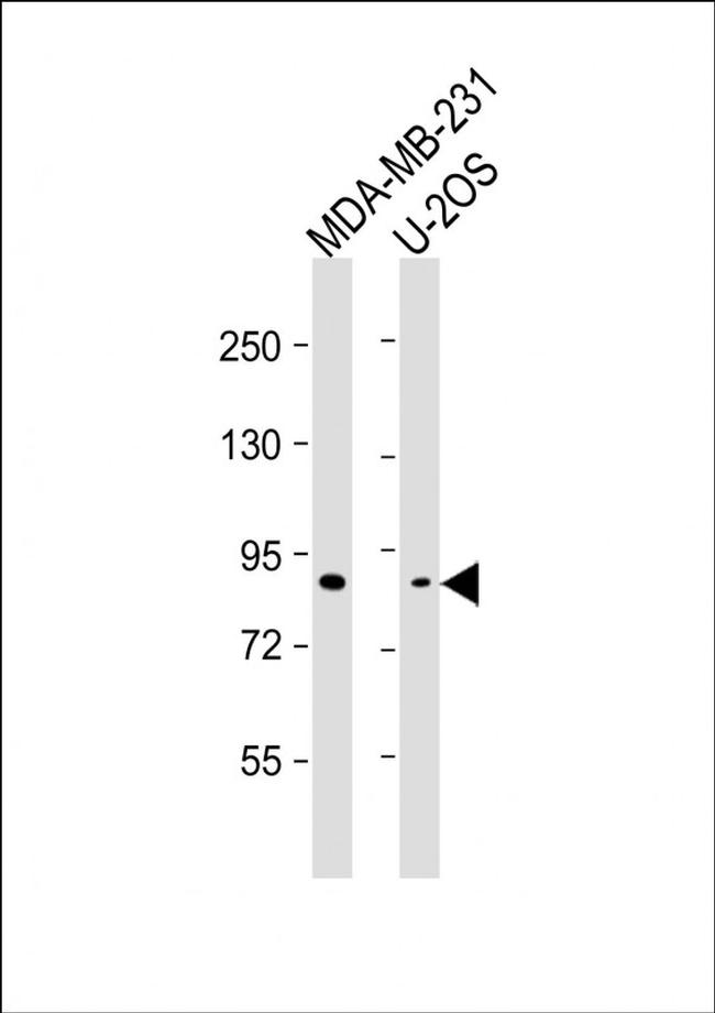 SMURF2 Antibody in Western Blot (WB)