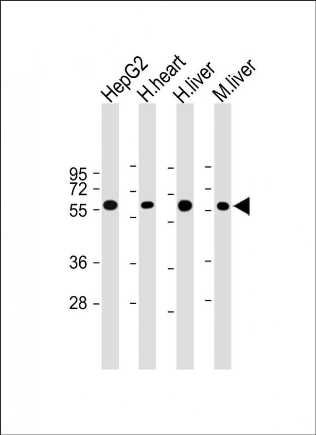 CRY2 Antibody in Western Blot (WB)