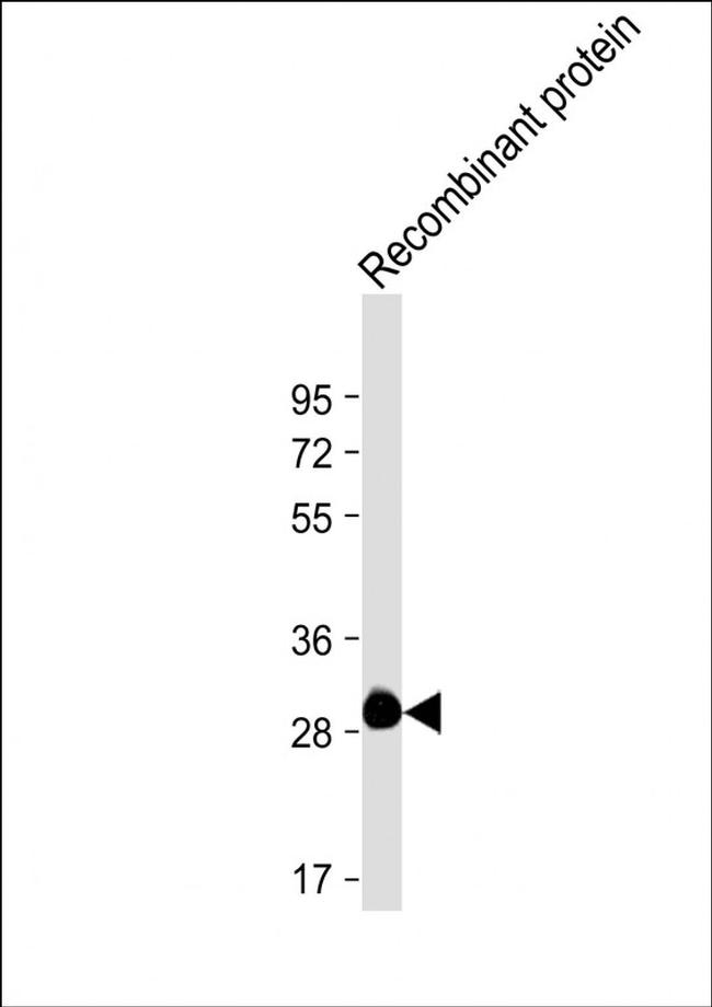 ROS1 Antibody in Western Blot (WB)