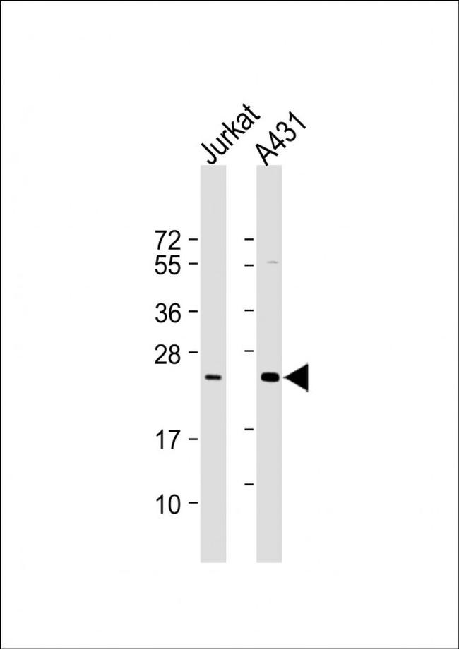 RAB29 Antibody in Western Blot (WB)