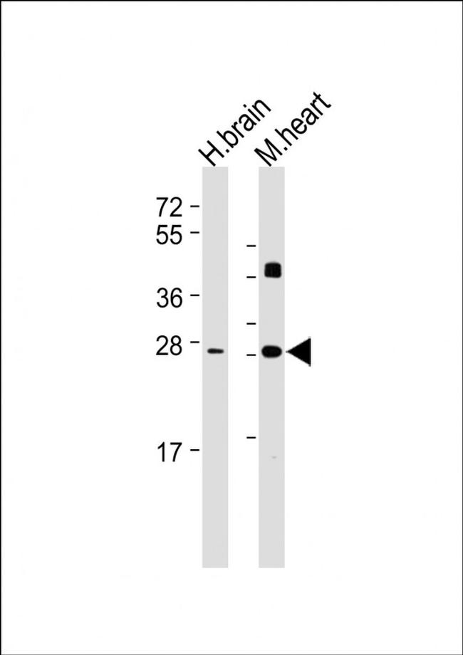 DKK2 Antibody in Western Blot (WB)