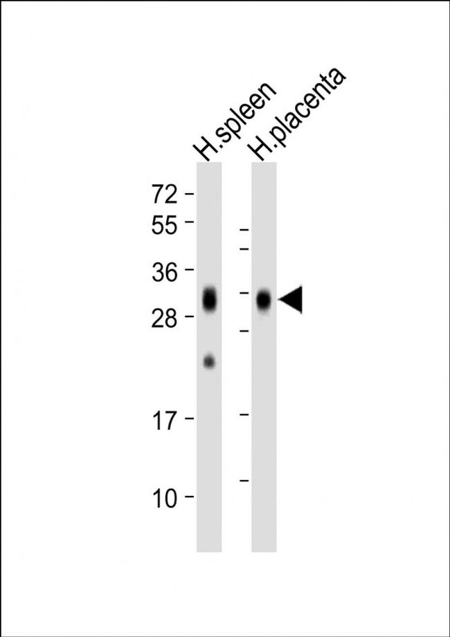 FOLR2 Antibody in Western Blot (WB)