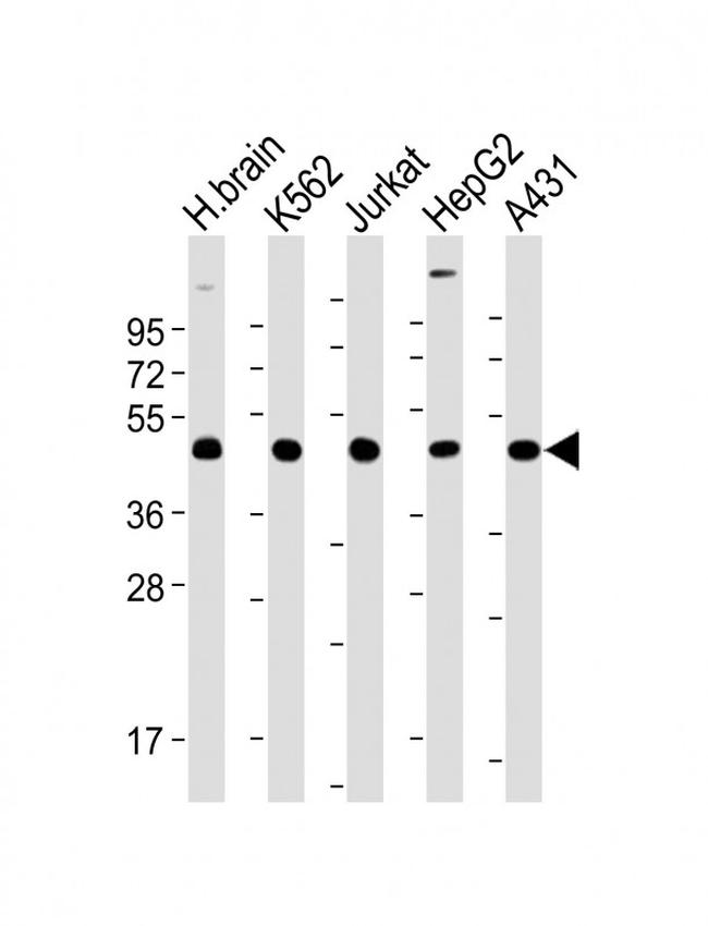 TSG101 Antibody in Western Blot (WB)