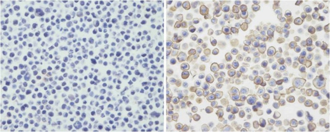 CD273 (B7-DC) Antibody in Immunohistochemistry (Paraffin) (IHC (P))