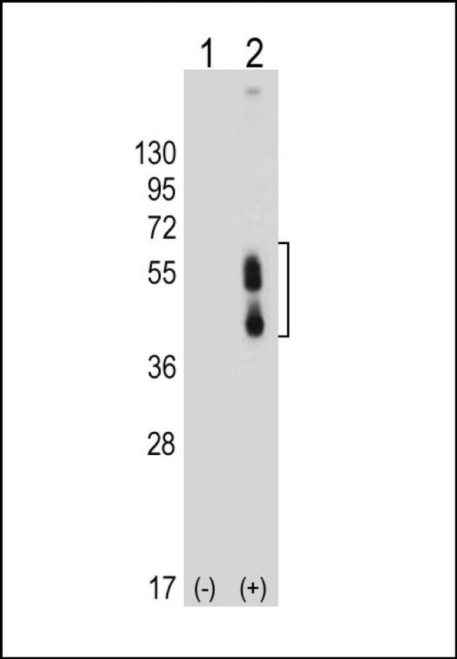 CD273 (B7-DC) Antibody in Western Blot (WB)