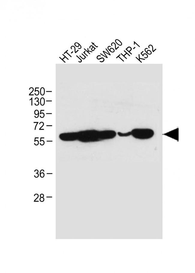 RIP3 Antibody in Western Blot (WB)