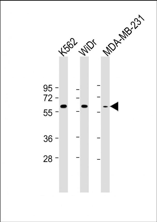 NUP54 Antibody in Western Blot (WB)