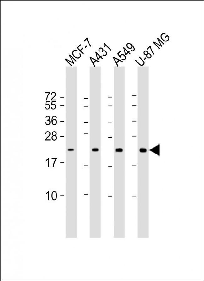 RAB13 Antibody in Western Blot (WB)