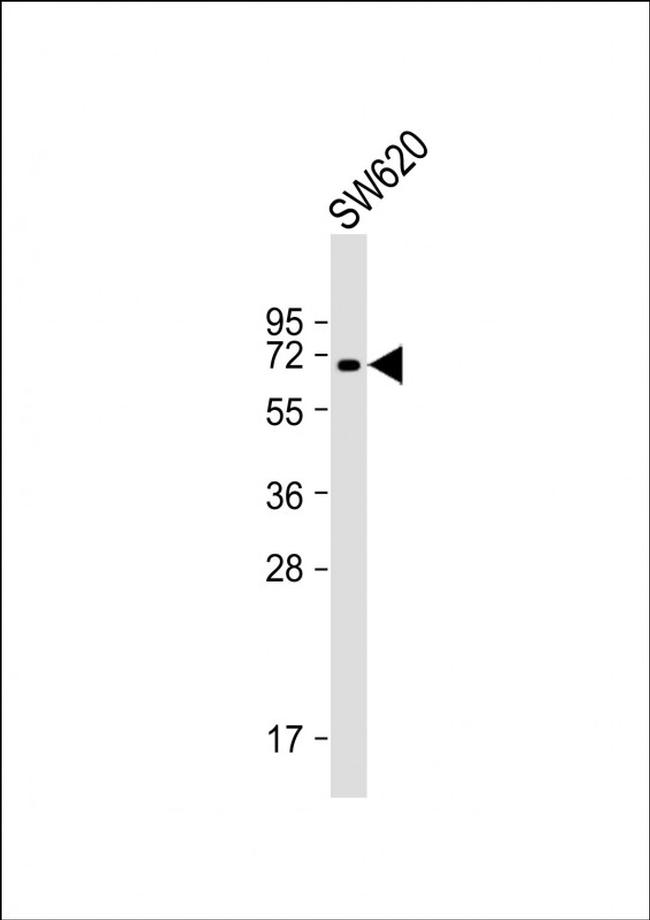 HAS2 Antibody in Western Blot (WB)