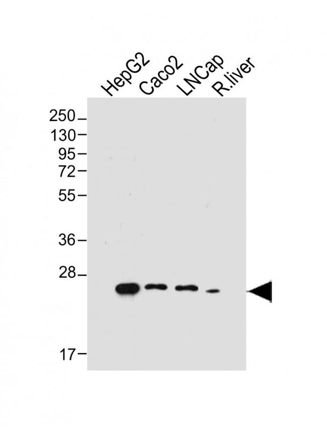 GSTA1 Antibody in Western Blot (WB)