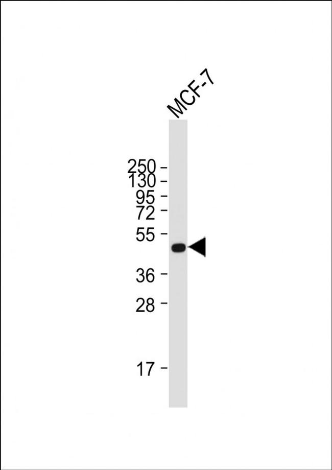 SULT2B1 Antibody in Western Blot (WB)